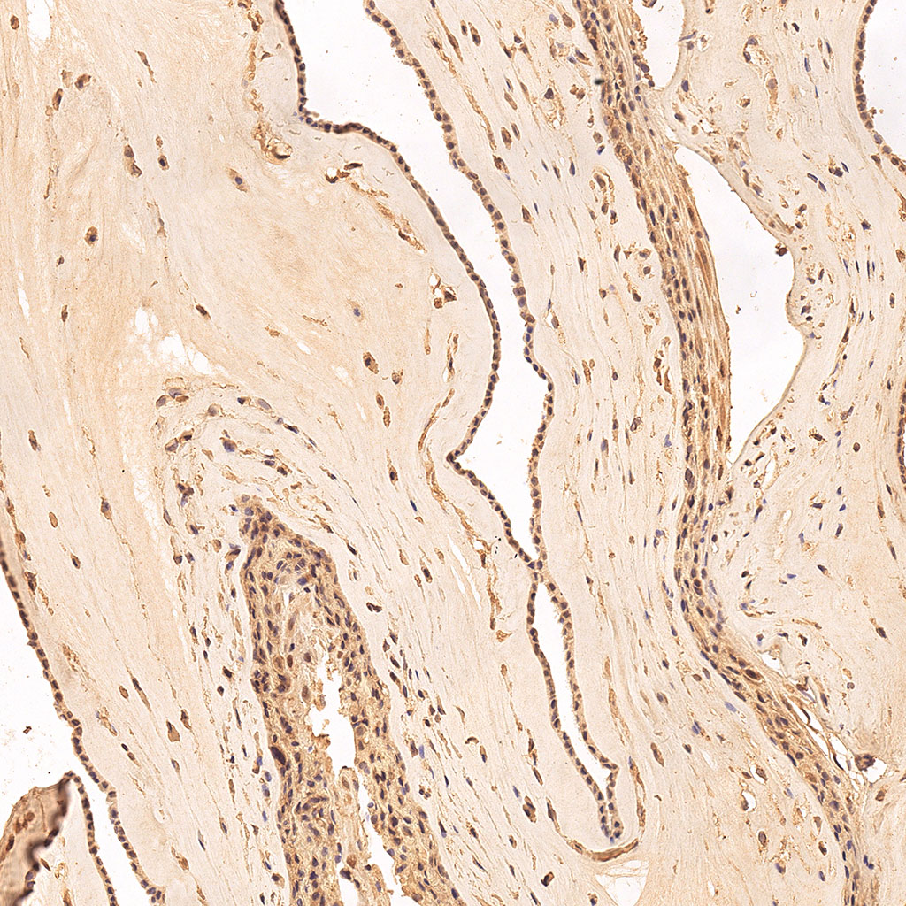 sars-cov-2 gene expression in a human fetus